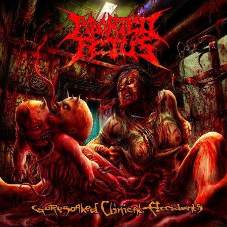 Aborted Fetus - Goresoaked Clinical Accident